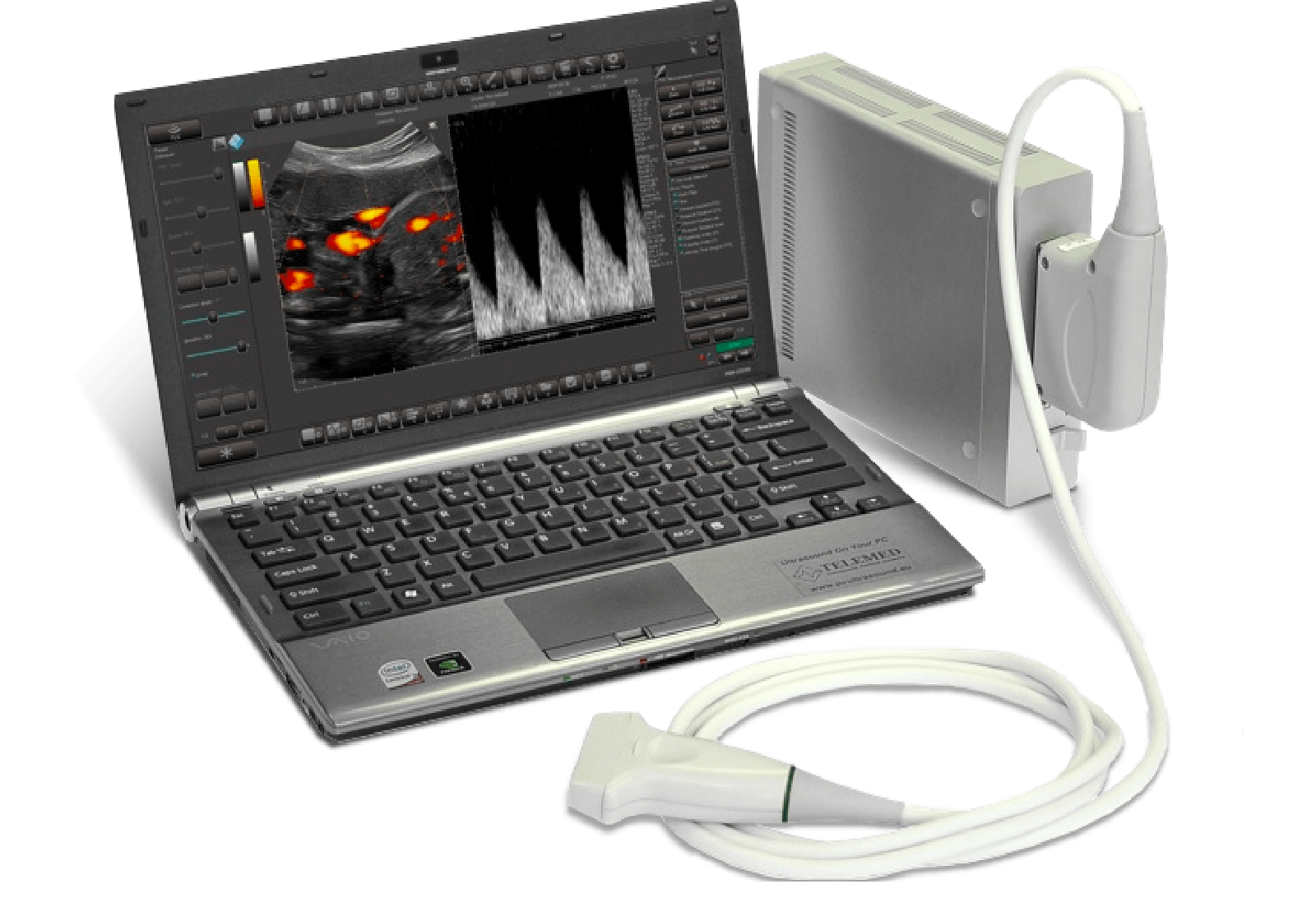 sonoview